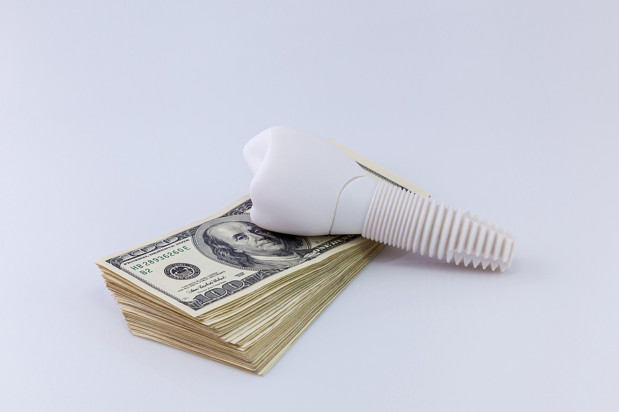 How Much Do Dental Implants in Northgate Cost?