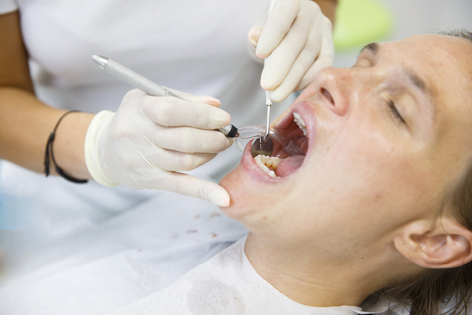 Preventative Dentistry 101: How Routine Cleanings Can Save Your Smile and Wallet
